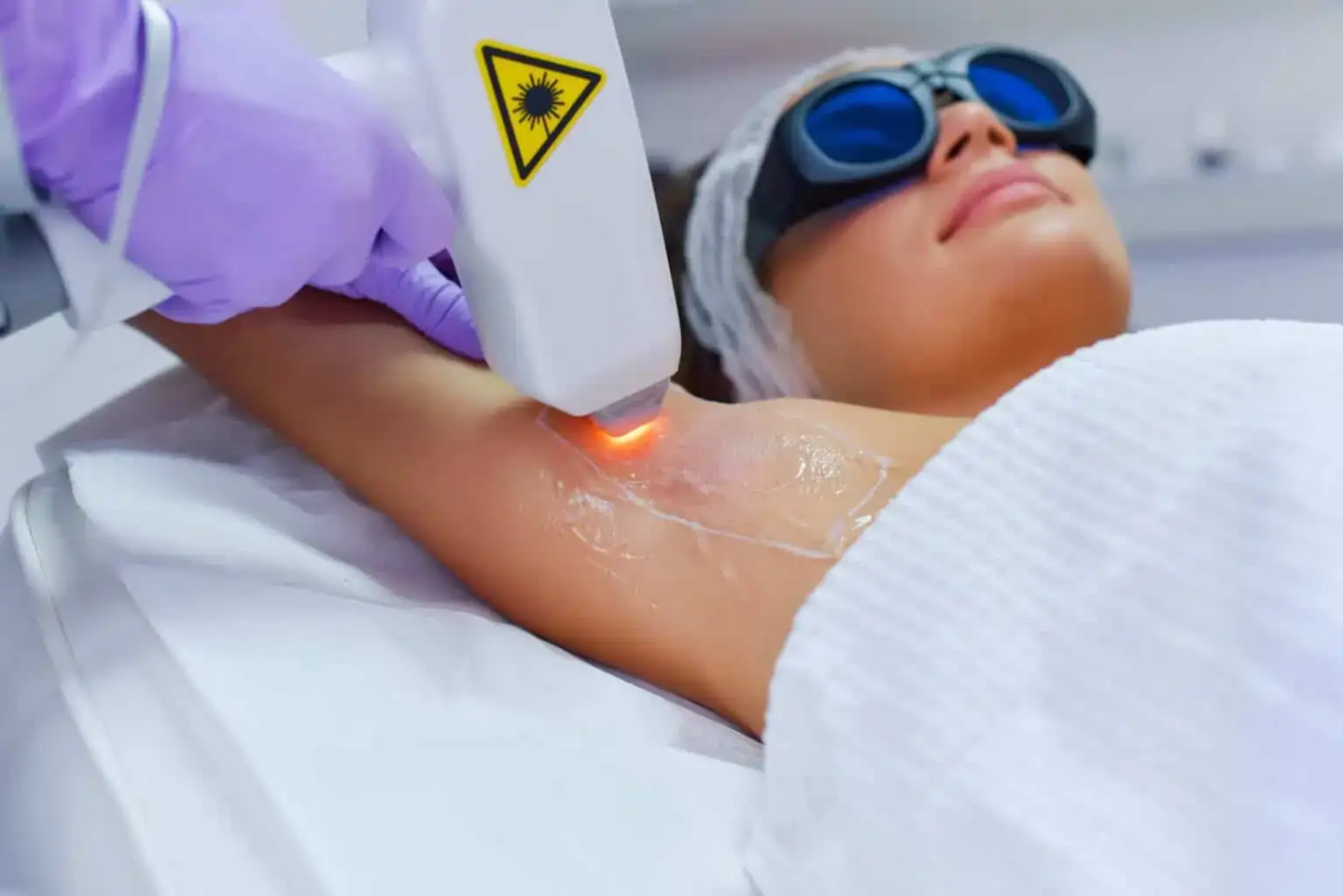Laser-Hair-Removal